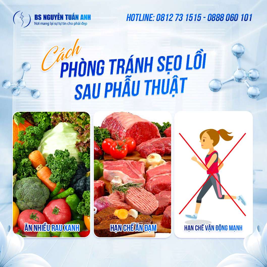 Cắt mí bị lồi sẹo có khắc phục được không?
