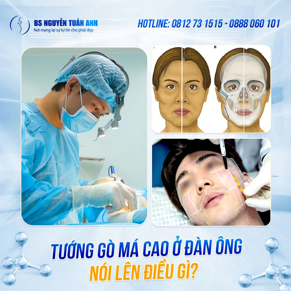 Gò má đàn ông – Dấu ấn quyền lực hay “con dao hai lưỡi” với diện m